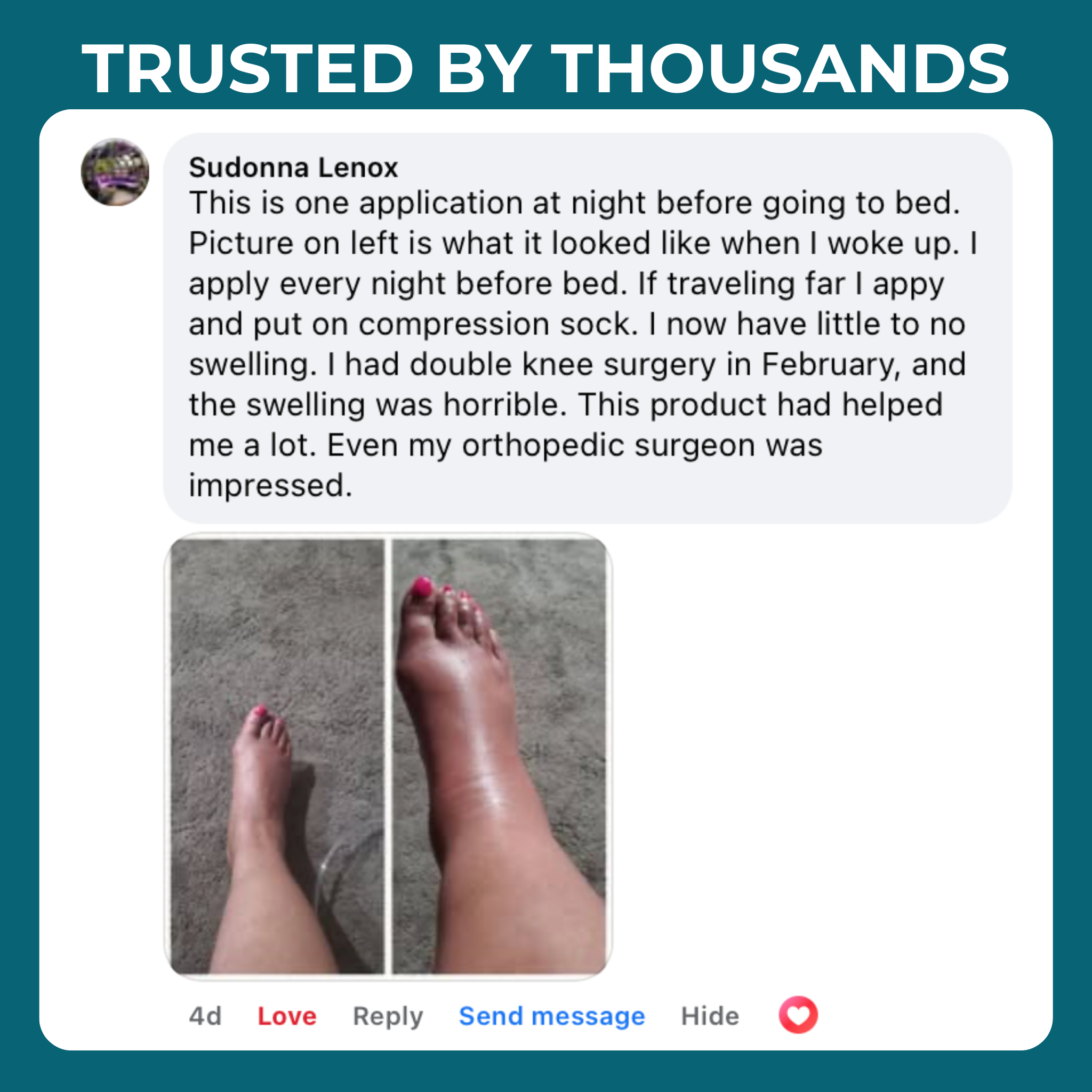 MIRACLE BALM FOR PAIN RELIEF [BUY 1 GET 1 FREE]